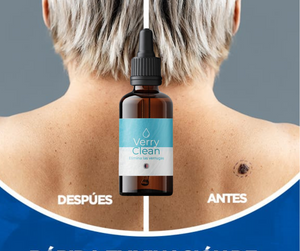 Elimina Verrugas con Verryclean