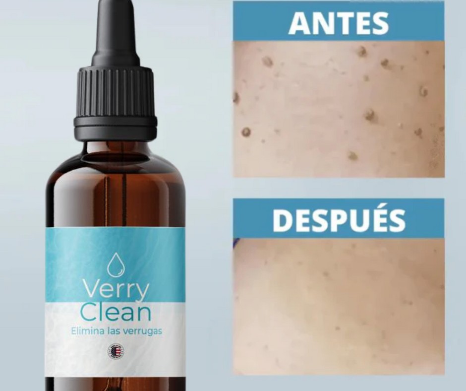 Elimina Verrugas con Verryclean